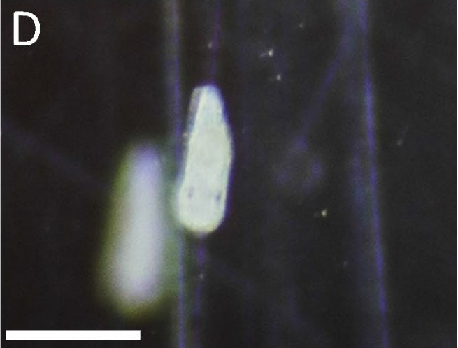 Post-metamorphosis juvenile Phestilla subodiosa, Yiu and Qiu 2022 Figure 5D, 300 micrometre scale