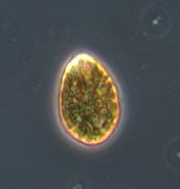 Ostreopsis cf. ovata under a microscope; other dinoflagellate groups look different.