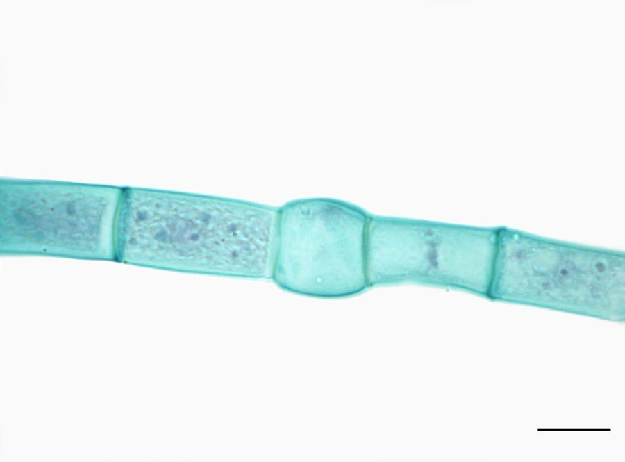 Microscope view of freshwater Oedogonium filaments.