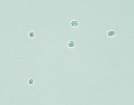 Nannochloropsis under a microscope; live phytoplankton is individually microscopic.