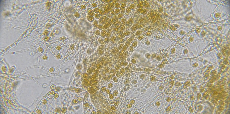 Golden algae / chrysophytes close-up reference