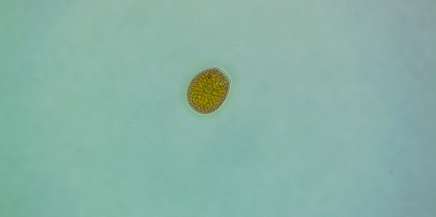 Large-cell Amphidinium close-up reference