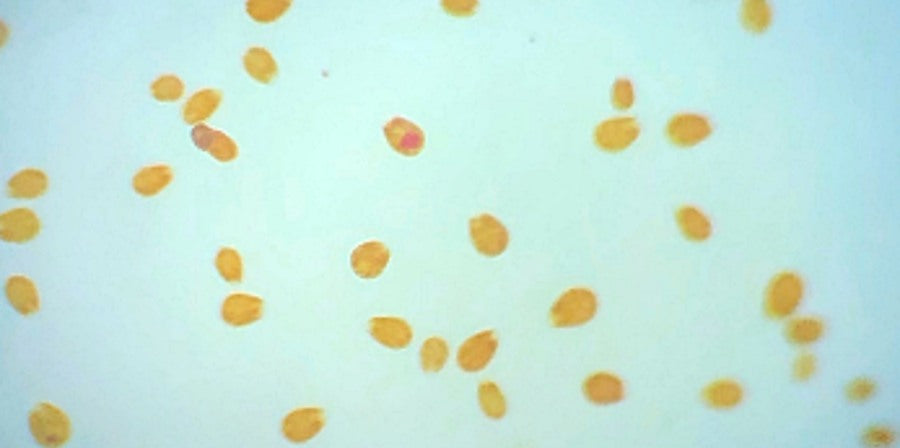 Ostreopsis close-up reference